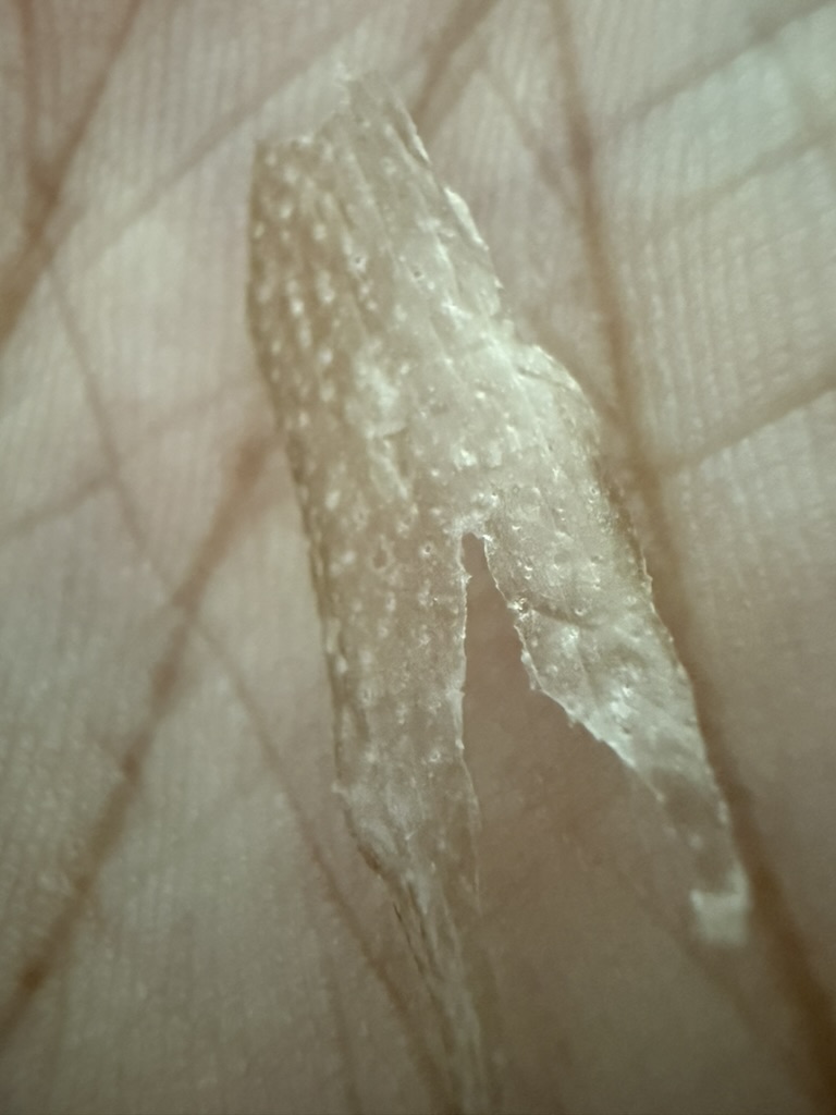 大面积脱皮
